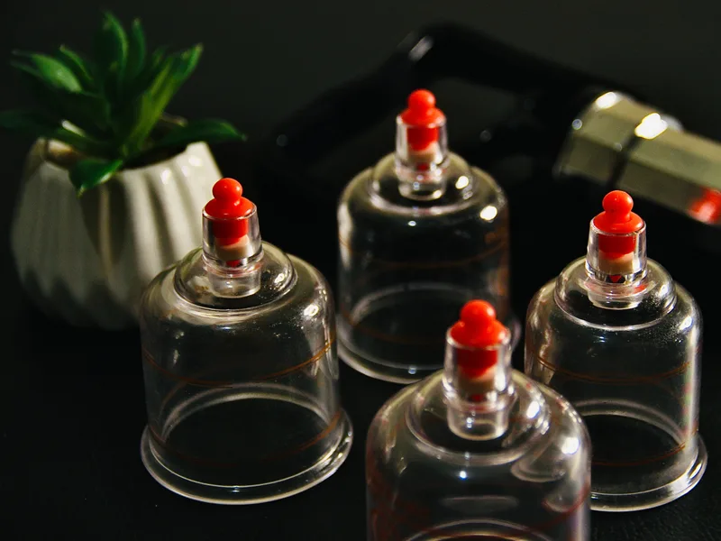 How Cupping Therapy works at Big Spirit Chiropractic