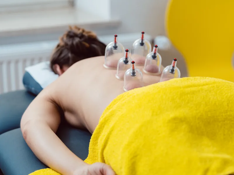 Cupping Therapy at Big Spirit Chiropractic in Spirit Lake