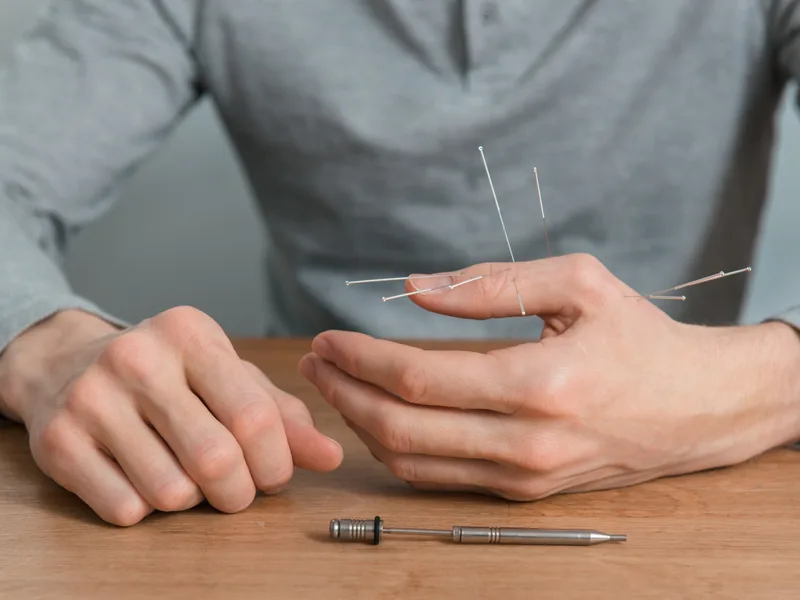 Dry Needling at Big Spirit Chiropractic in Spirit Lake