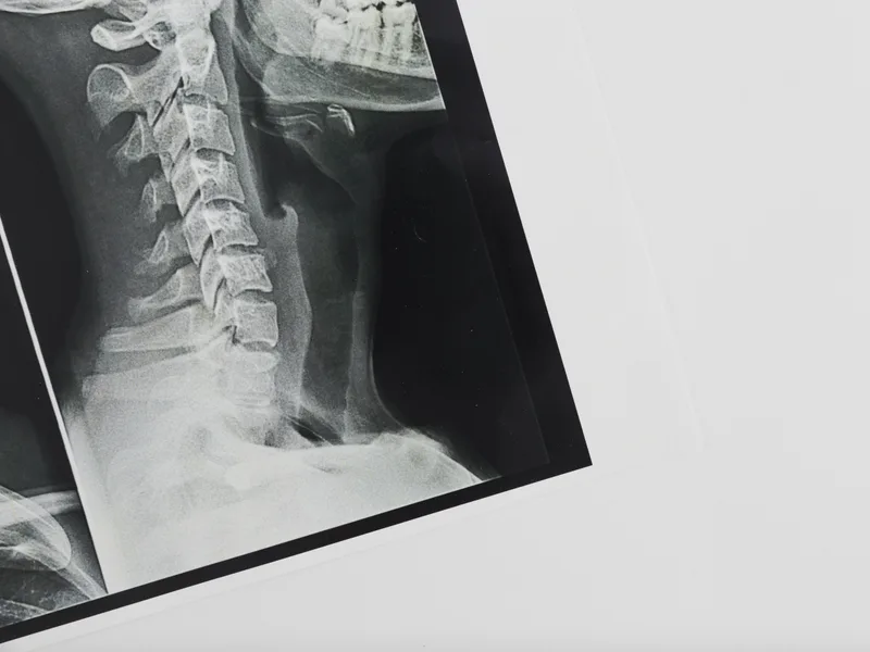 X-Rays at Big Spirit Chiropractic in Spirit Lake